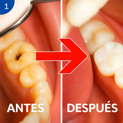 Recupera la Fuerza de tu Sonrisa